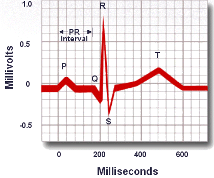 PR interval should be 120 to 200 milliseconds or 3 to 5 little squares