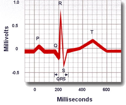 The width of the QRS complex should not exceed 110 ms, less than 3 little squares