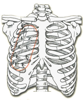 Flail Chest