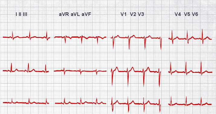 The 10 Rules for a Normal ECG