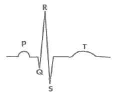 PQRST of the ECG