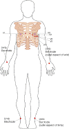 Electrode Placement